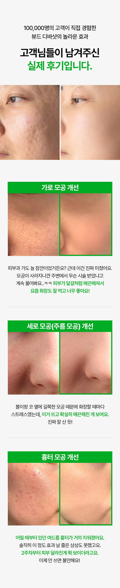 VUDE - Ultra-Low Molecular Diva Shot (Pore Care Beauty Device)