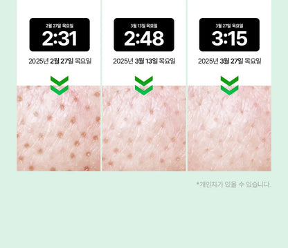 VUDE - Ultra-Low Molecular Diva Shot (Pore Care Beauty Device)