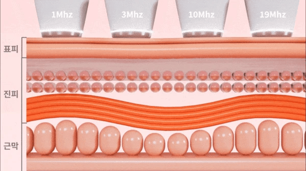 CLABIANE - Oligihome Beauty Device
