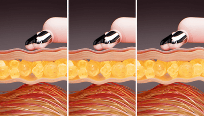MEDICUBE AGE-R BOOSTER V ROLLER (BEAUTY DEVICE)