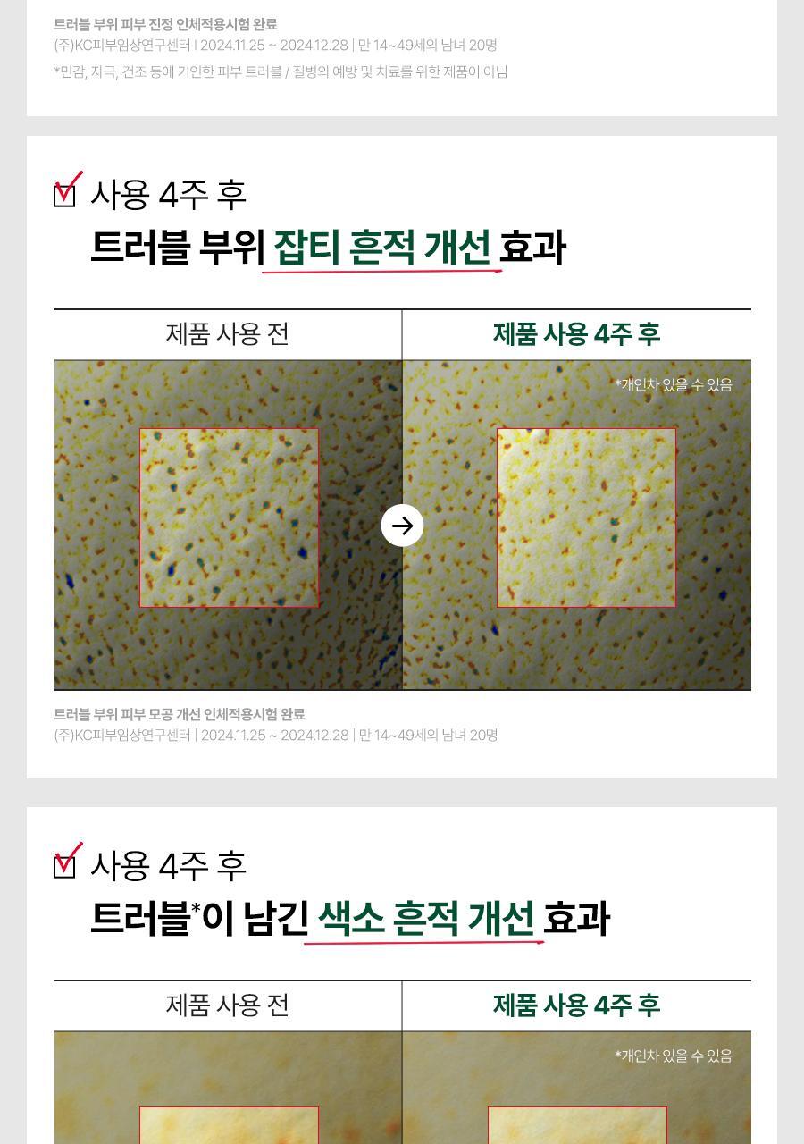 Dr.G - Red Blemish Clear Hyal-Cica Soothing Serum 50ml + Refill + Squirtle Pouch (Pokémon Collaboration)