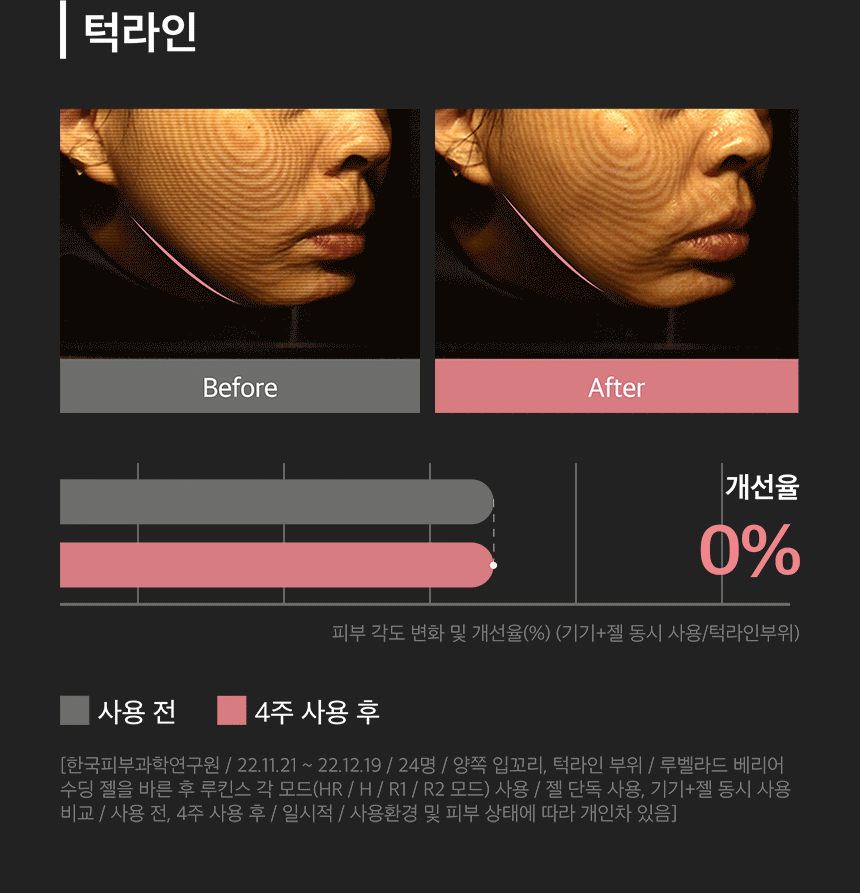 LUKINS - Pro Beauty Device [New Launch!]