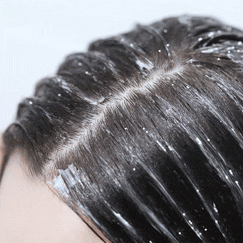 Original scalp treatment application demonstration.
