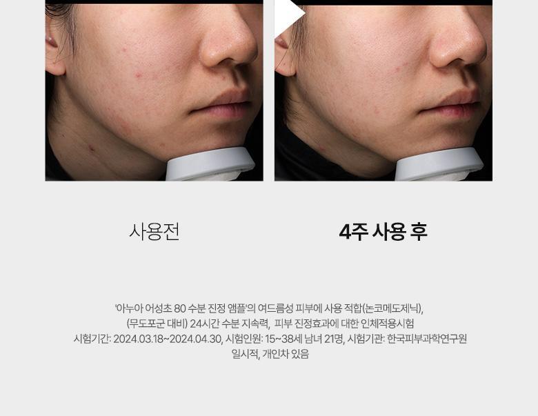 Anua - Heartleaf 80 Panthenol Ampoule 30ml (1+1)