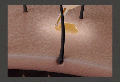 resnovae Hyper Shot (Advanced Scalp &amp; Hair Care Device)