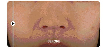 Centellian24 - Madeca Prime Max (Hyper Lifting &amp; Firming Beauty Device)