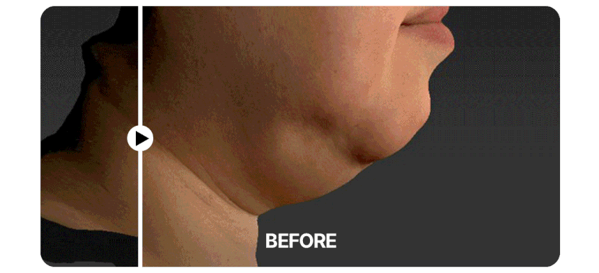 Centellian24 - Madeca Prime Max (Hyper Lifting &amp; Firming Beauty Device)