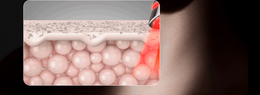 Centellian24 - Madeca Prime Max (Hyper Lifting &amp; Firming Beauty Device)