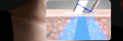 Centellian24 - Madeca Prime Max (Hyper Lifting &amp; Firming Beauty Device)