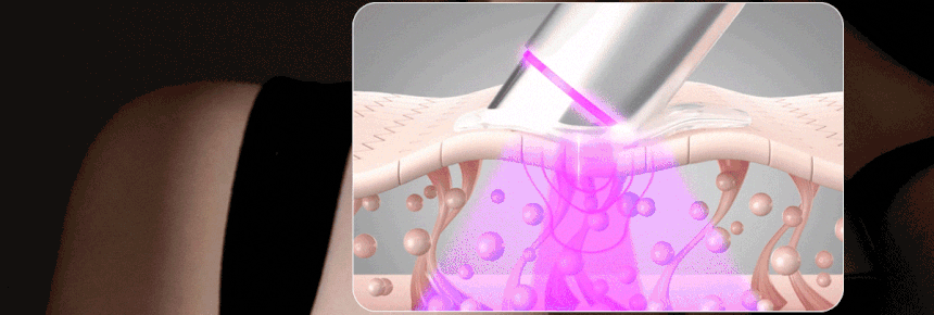 Centellian24 - Madeca Prime Max (Hyper Lifting &amp; Firming Beauty Device)