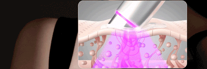 Centellian24 - Madeca Prime Max (Hyper Lifting &amp; Firming Beauty Device)