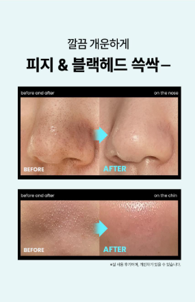 ilso Super Melting Sebum Softener 150ml (+40 Cotton Pads)