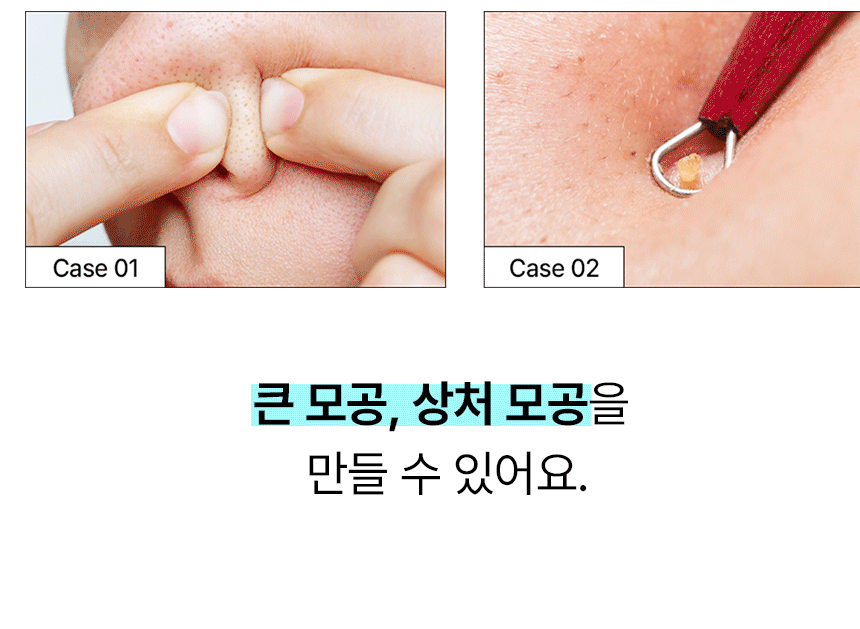 ilso Super Melting Sebum Softener 150ml (+40 Cotton Pads)
