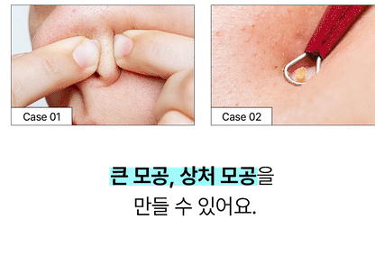 ilso Super Melting Sebum Softener 150ml (+40 Cotton Pads)