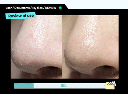 ilso Super Melting Sebum Softener 150ml (+40 Cotton Pads)